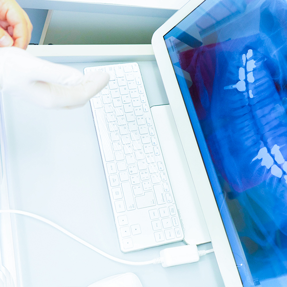 Implantologia Aragona dentista servizio per la cura del tuo cavo orale